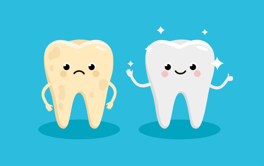 Illustration of a happy white tooth next to a sad yellow tooth affected by discoloration